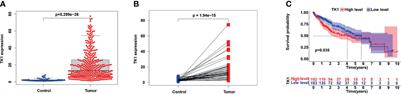 Comprehensive Analysis of Immune-Related Prognosis of TK1 in Hepatocellular Carcinoma